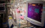 Bebé prematuro ingresado en una unidad de cuidados intensivos neonatales