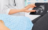 Una doctora muestra una ecografía a una mujer embarazada