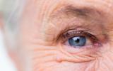 Mujer mayor con problemas capilares oculares