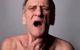Hombre con problemas de mucositis oral