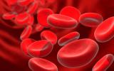 Anemia o disminución de la concentración de hemoglobina en la sangre