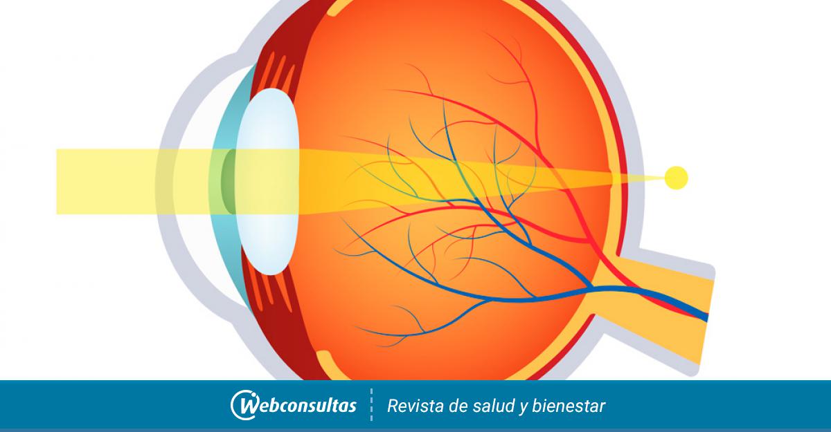 demodex oftalmologie lipsa termenului de viziune