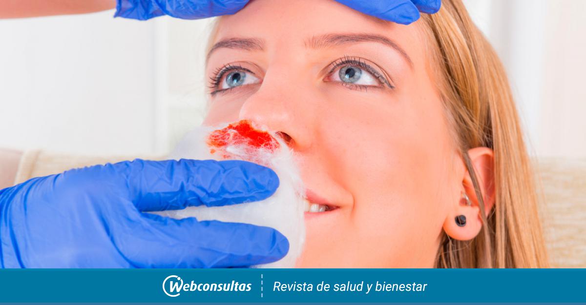Desalentar uvas veneno Hemorragia nasal: qué hacer y qué no hacer cuando sangra la nariz
