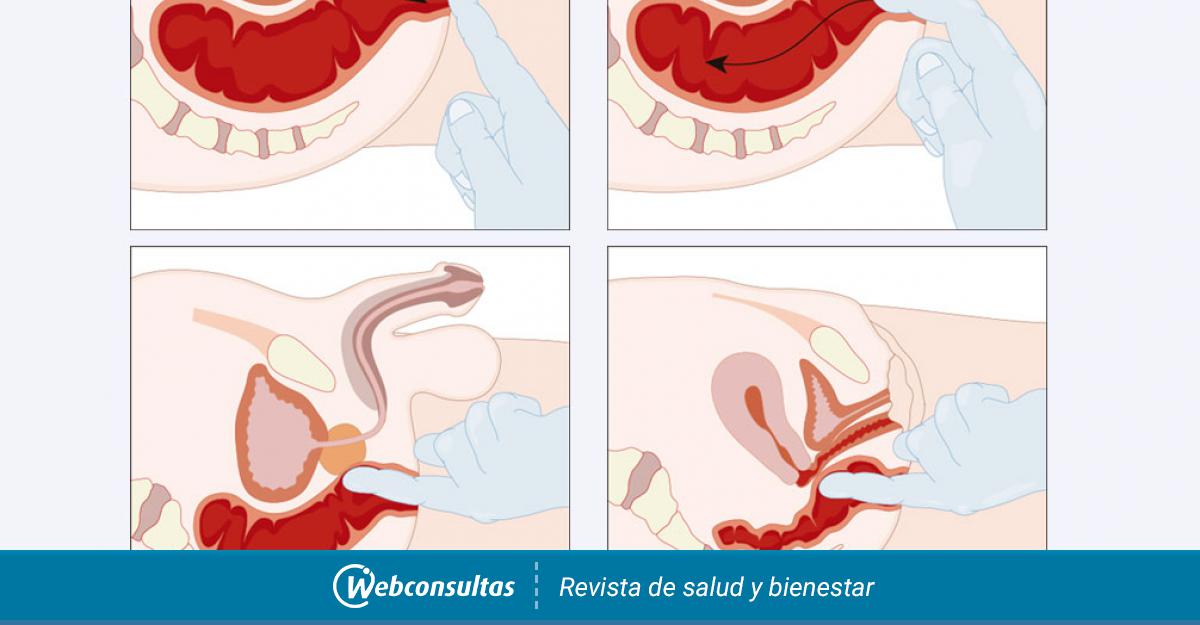 examen de la próstata tacto rectal oxalati de prostatita