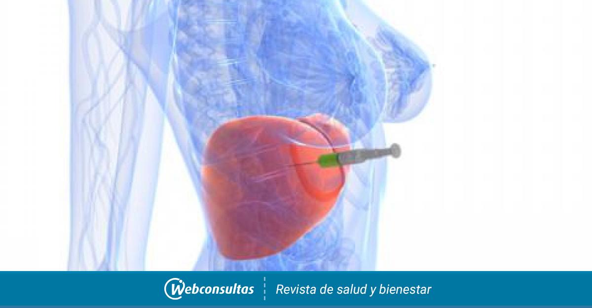 Cómo se hace la biopsia hepática - Pruebas Médicas