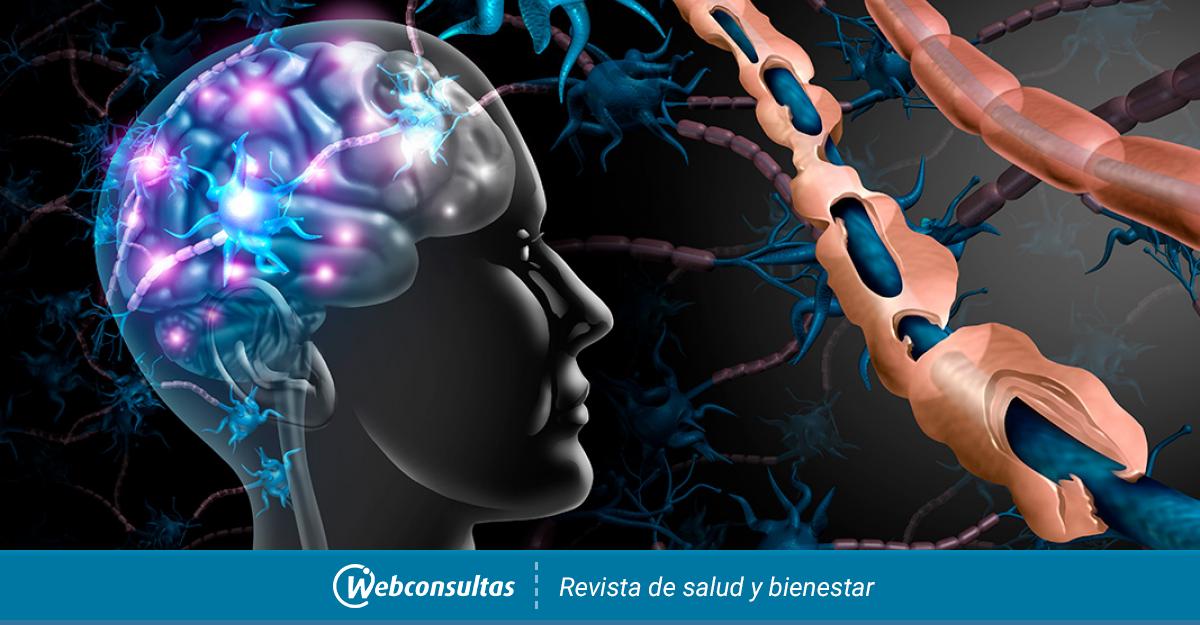 Una Nueva Terapia Puede Mejorar El Tratamiento De Esclerosis Multiple