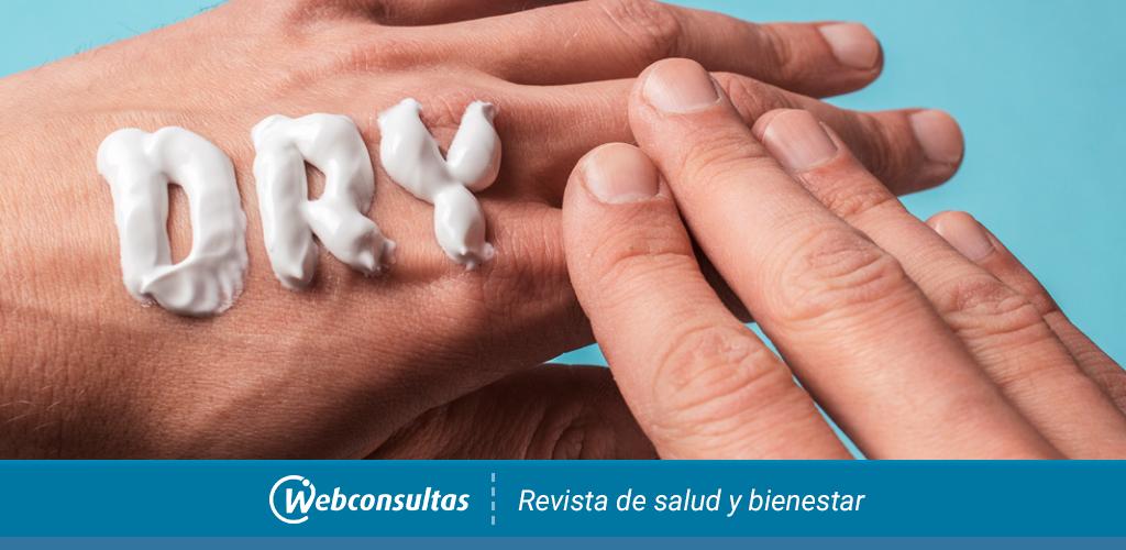 enfocar Inmunizar Sueño Manos secas o agrietadas: 12 consejos para mantener su piel suave