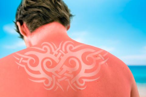 Espalda de un hombre con un dibujo realizado con Sunburn Art