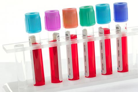 Tubitos con sangre listos para ser analizados en el laboratorio