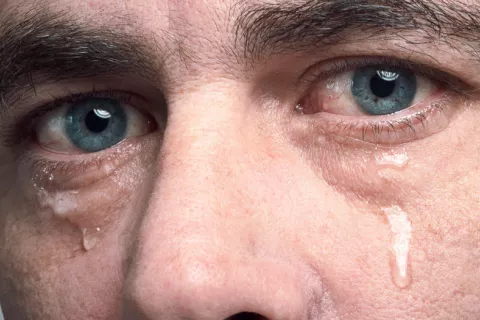 Ojos llorosos o lagrimeo constante Persona con lágrimas en los ojos