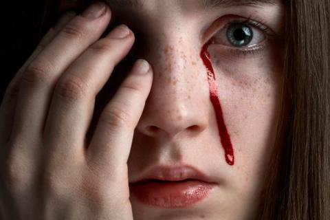 Hemolacria: ¿Es posible llorar sangre?