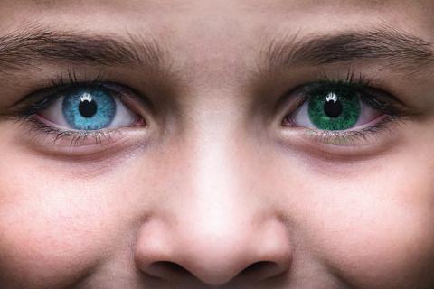 Heterocromía: tener cada ojo de un color