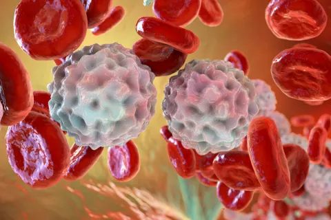 Por qué suben los linfocitos y cuándo preocuparse Linfocitosis: causas de los linfocitos altos y cómo bajarlos