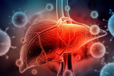 Virus de la hepatitis provocando un cáncer de hígado