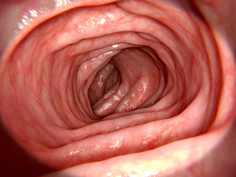 Sigmoidoscopia, interior del colon