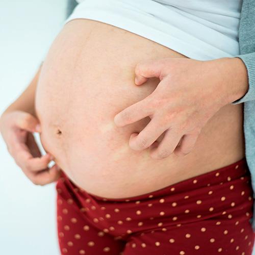 Embarazada con prurito por alergia rascándose la barriga