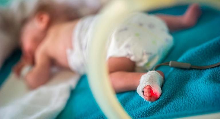 Infección por klebsiella en bebés prematuros