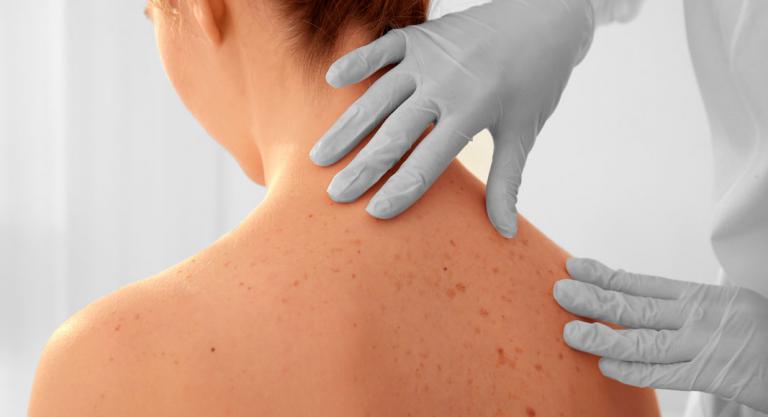 Examen dermatológico de la piel