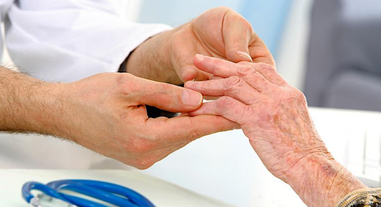 Síntomas de la artritis reumatoide en las manos
