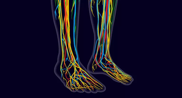Eritromelalgia