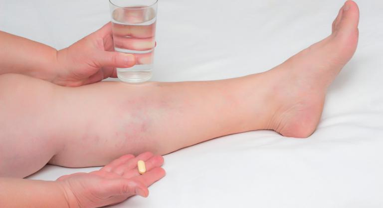 Frugal Crueldad Lavar ventanas Síndrome de pies ardientes: causas, síntomas y cómo se alivia