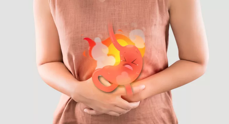 Mujer con gastritis