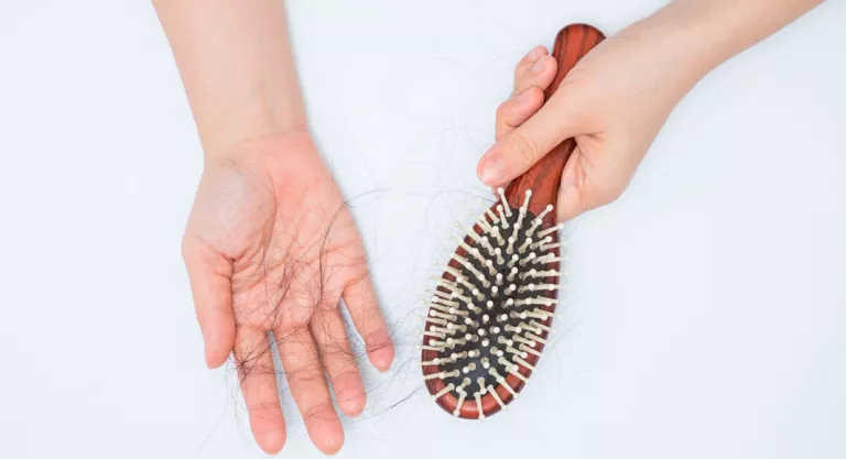 Pérdida de cabello durante el embarazo