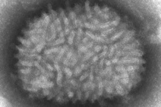Científicos del CSIC trabajan en una vacuna para el coronavirus a partir del virus que erradicó la viruela