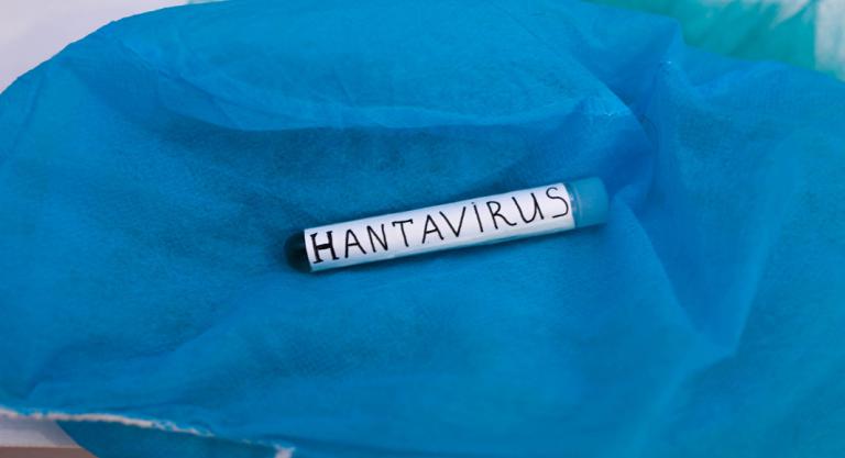Infección por hantavirus