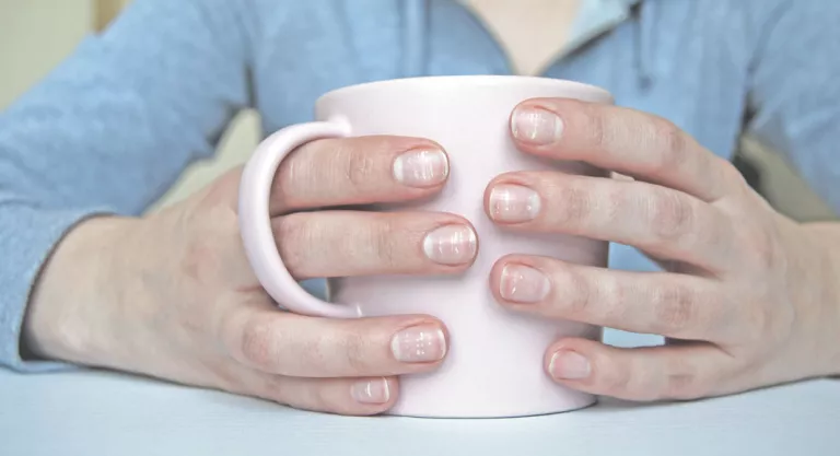 Mujer con pintas blancas en las uñas