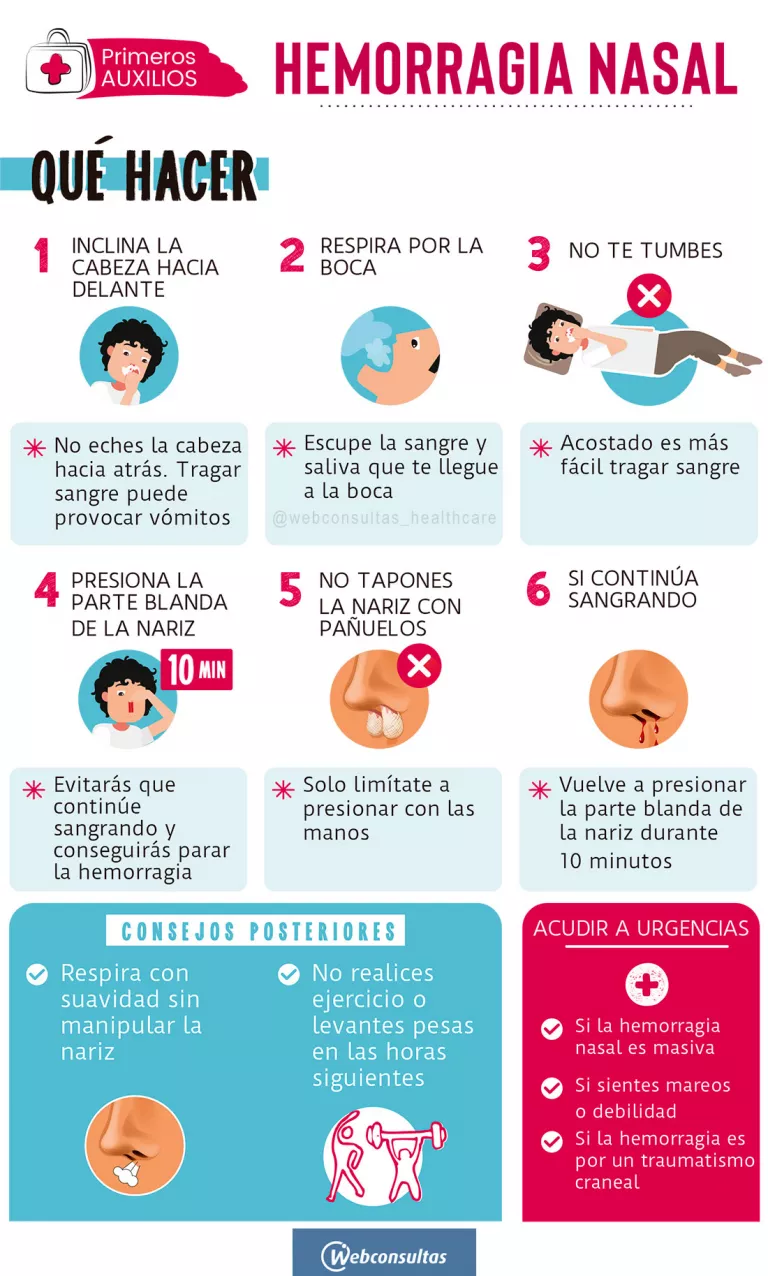 Infografía: Hemorragia nasal