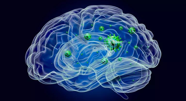 Secuelas del COVID-19: neuropatías secundarias