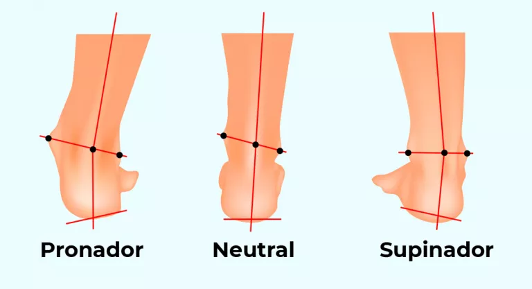 Tipos de pisada