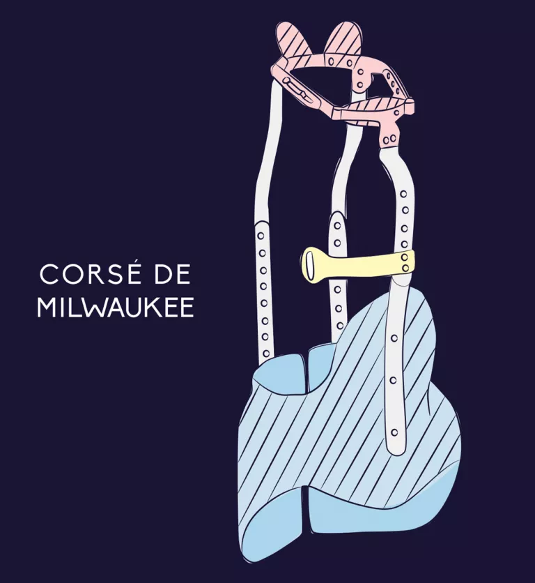 Corsé de Milwaukee