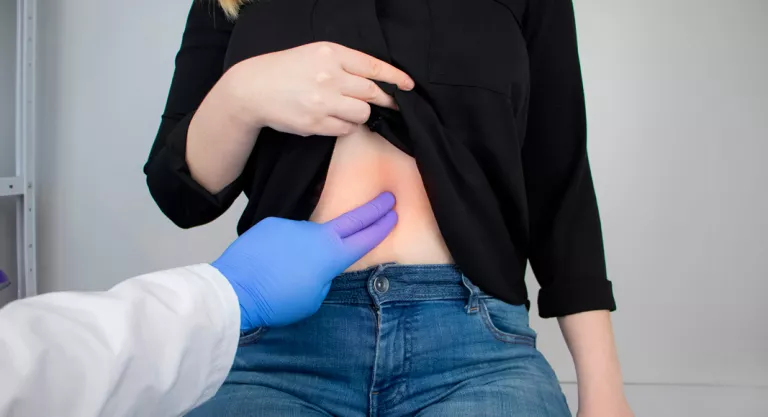 Diagnóstico del colon irritable: dolor abdominal