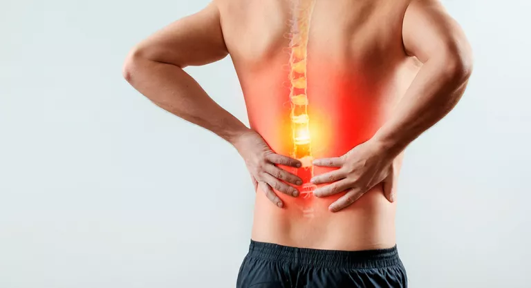 Síntomas de las radiculopatías: dolor lumbar