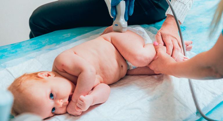 Prueba de ultrasonido para la displasia de cadera del bebé