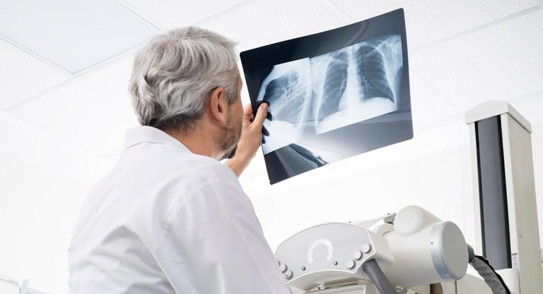 Radiografía de tórax para diagnosticar la bronquilitis