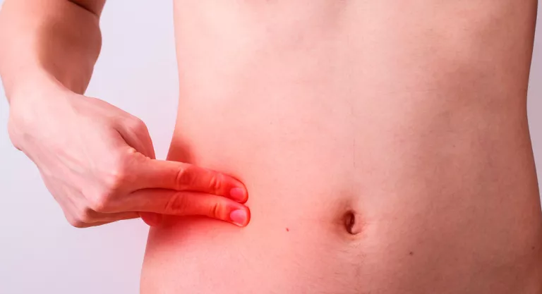Sintomas De La Apendicitis En Adultos Ninos Y Embarazadas