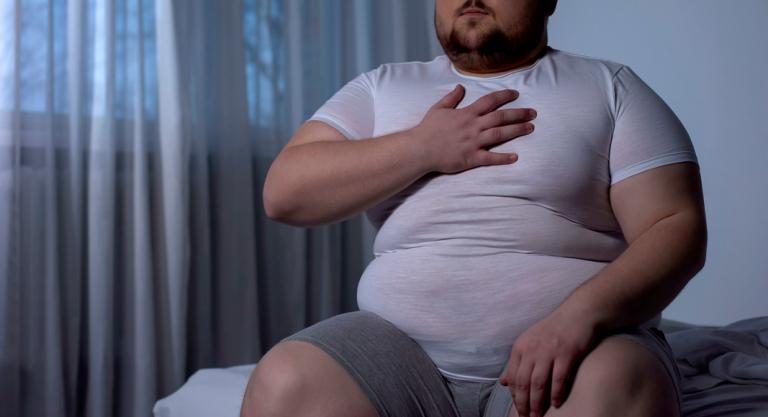 Causas de aneurisma: obesidad