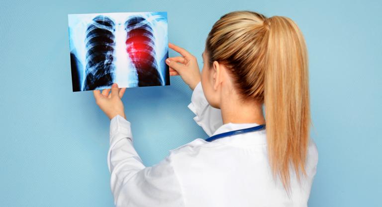Diagnóstico del cáncer de pulmón