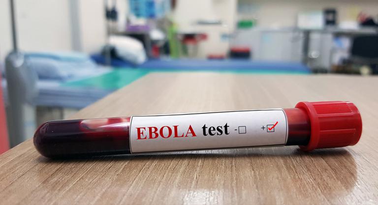 Diagnóstico de la infección por virus del Ébola