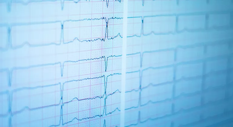 Diagnóstico de la endocarditis