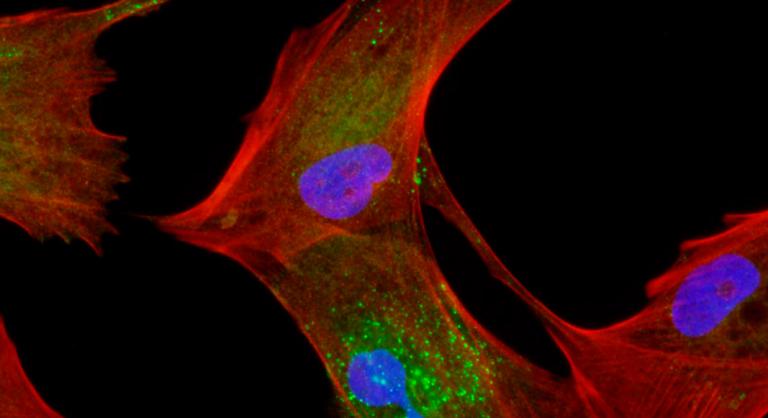 Células tras sufrir la transición al epitelio