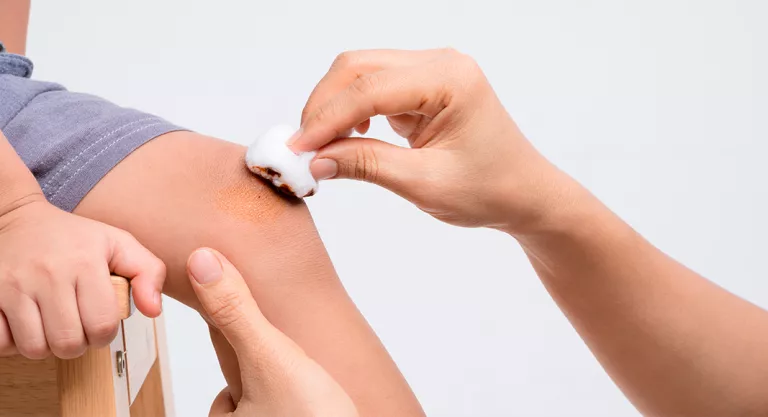 Curar heridas con povidona yodada