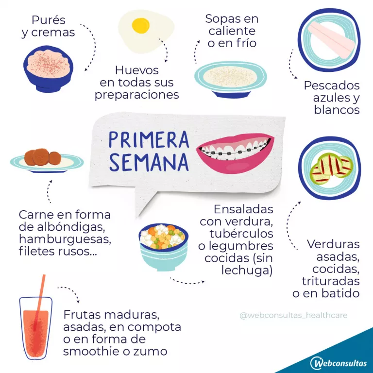 Infografía: Qué comer con brackets y qué alimentos evitar 