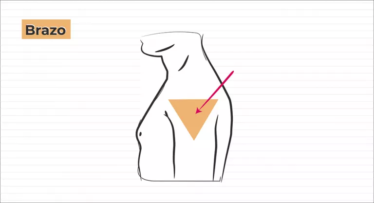 Inyección intramuscular en brazo