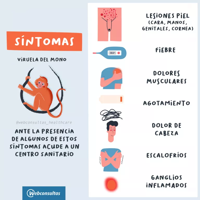 Infografía síntomas de la viruela del mono