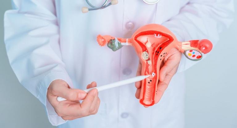 Doctor sosteniendo un modelo 3D de un útero