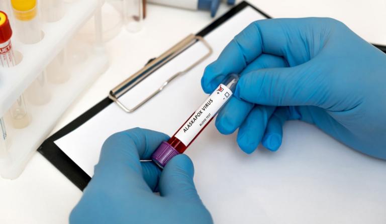Científico analizando una muestra de sangre contagiada con el virus Alaskapox